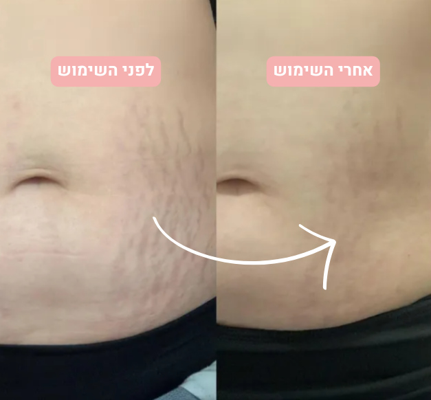 שמן פרי ורדים