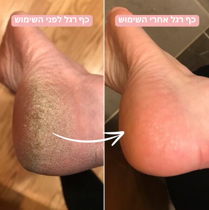 מכשיר פדיקור חשמלי מבית אופטילר