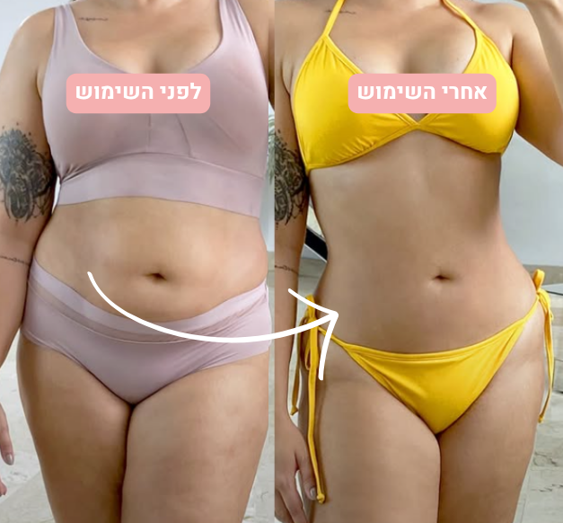מכשיר עיסוי חשמלי מבית אופטילר - ™OptiSculpt